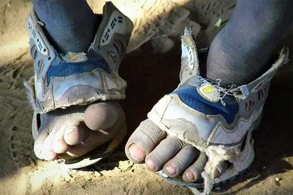 Badly fitting shoes